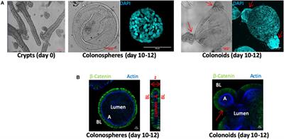 Characterization of Human Colon Organoids From Inflammatory Bowel Disease Patients